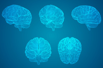 为什么要做刹车油更换？